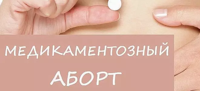 Медикаментозное прерывание беременности: что нужно знать пациентке