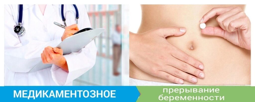 Медикаментозное прерывание беременности: что нужно знать пациентке